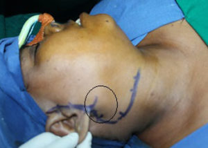 Head and Neck Surgical Services
